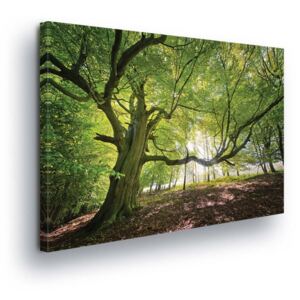 Obraz na plátne - Tree crown 3 x 30x100 cm